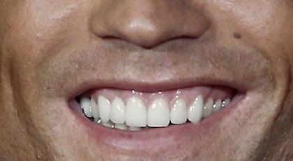 Μπορείς να αναγνωρίσεις τον ποδοσφαιριστή μόνο από το χαμόγελο του;