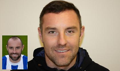 Μεταμόσχευση μαλλιών: Τι ζητούν οι αθλητές