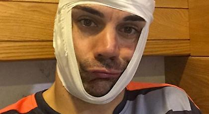 Σοκαριστικός τραυματισμός του Πάρντο (pics)