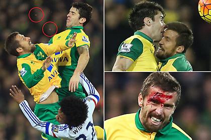 Ο ένας ξεδοντιάστηκε, ο άλλος αιμορράγησε (pics)