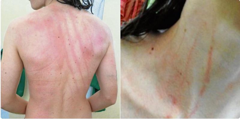 Απίστευτος ξυλοδαρμός παικτριών σε γυναικείο ματς στην Ισπανία (pics)