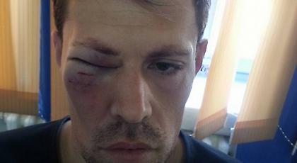 Ξυλοκοπήθηκε άγρια επόπτης στη Ρουμανία