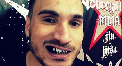 Νεκρός ΜΜΑer μετά από σοβαρότατο τραύμα στο κεφάλι!