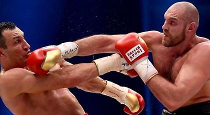 Ο Κλίτσκο ποζάρει με φανέλα της Μάντσεστερ Σίτι