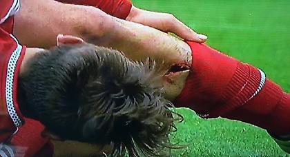 Του άνοιξε... τρύπα στο πόδι με σκαριά (video)