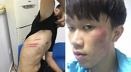 Απίστευτο ξύλο σε ποδοσφαιρικό αγώνα στην Κίνα! (pics+video)