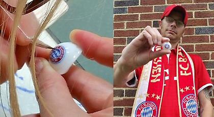 Ο οπαδός της χρονιάς: Έχασε το μάτι του και στο ψεύτικο ζωγράφισε το σήμα της Μπάγερν! (pics)