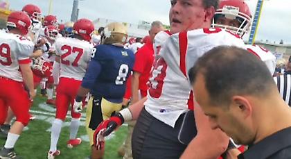 Ξύλο με τραυματίες σε αγώνα φούτμπολ αστυνομικών και πυροσβεστών! (pics/video)