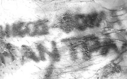 Έκαψαν ζωντανό τον 50χρονο στα λιμανάκια Βουλιαγμένης