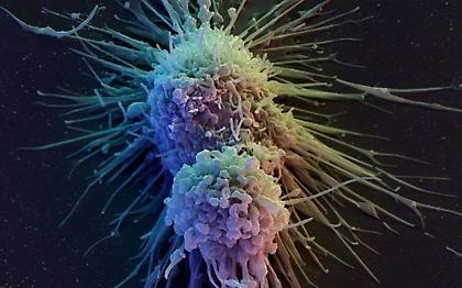 Ανησυχία από την αύξηση των κρουσμάτων καρκίνου του στόματος