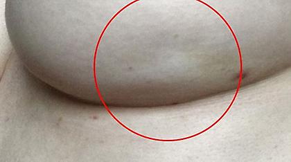 Πώς μια φωτογραφία στο facebook έσωσε μια γυναίκα από τον καρκίνο