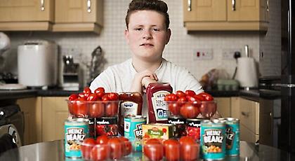 Έφηβος εθισμένος στη ντομάτα υπνωτίστηκε για να φάει άλλο φαγητό