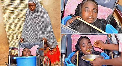 Το κοριτσάκι με τη σπάνια πάθηση που ζει μέσα σε μια πλαστική λεκάνη (pics)