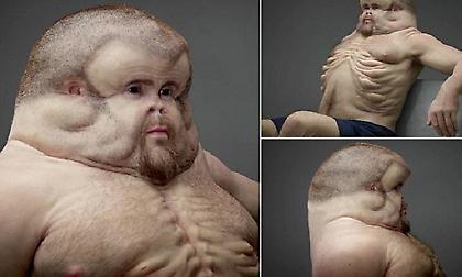 Graham: Αυτός είναι ο «άνθρωπος» που επιβιώνει σε όλα τα τροχαία