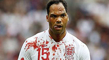 Ο κιτρινόμαυρος «Scarface»! (pics/video)