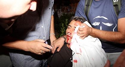 ΝΤΟΚΟΥΜΕΝΤΟ: Φωτογραφίες-σοκ από το άγριο ξύλο στην κλήρωση της Football League