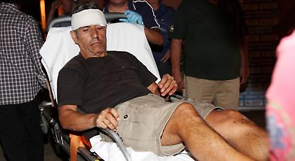 «Φοβήθηκα ότι θα έχανα το μάτι μου»