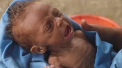 Στη Βενεζουέλα του Μαδούρο τα παιδιά «σβήνουν» από υποσιτισμό...