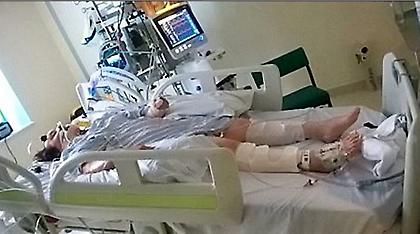 Απίστευτο: Οι γιατροί θα έκλειναν τη μηχανική υποστήριξη αλλά αυτή... κούνησε το δάχτυλό της