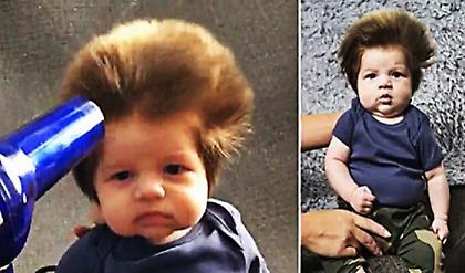 Αφάνας τσέπης: Το μωράκι των μόλις 9 εβδομάδων με το απίστευτο μαλλί που έγινε viral!