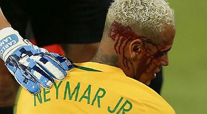 Την έφαγε γερά ο Νεϊμάρ (video)