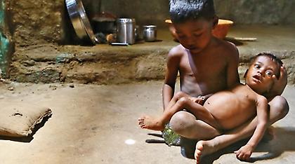 ΟΗΕ: Υποσιτισμένα πέντε στα έξι βρέφη στις αναπτυσσόμενες χώρες