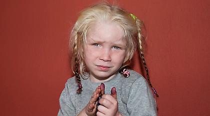 Η τρομακτική αλλαγή της μικρής Μαρίας – Πώς είναι σήμερα η ζωή της;