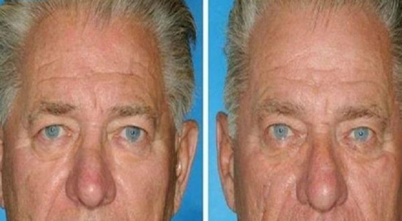 Οκτώ φωτογραφίες από δίδυμα αδέλφια που ένας από τους δυο καπνίζει!