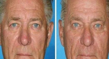 Οκτώ φωτογραφίες από δίδυμα αδέλφια που ένας από τους δυο καπνίζει!