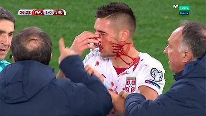 Γέμισε αίματα το πρόσωπο του Τάντιτς (pics)