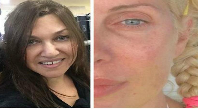 Έτσι είναι χωρίς μακιγιάζ… διάσημες Ελληνίδες! (pics)