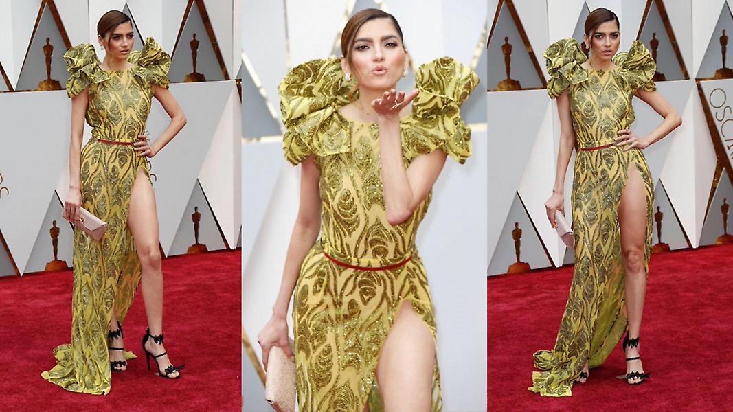 Αποκαλυπτικό ατύχημα από ηθοποιό που δεν φορούσε εσώρουχα στα Όσκαρ (pics)