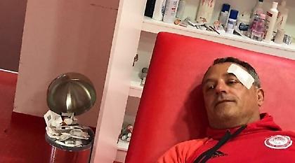 Οι φωτογραφίες του τραυματισμένου φροντιστή του Ολυμπιακού