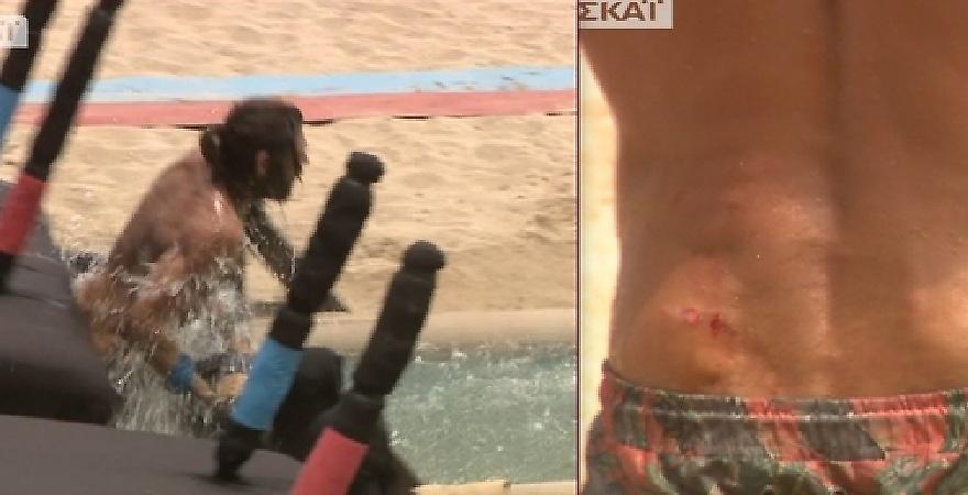 Survivor: «Τσακίστηκε» ο Γιάννης Σπαλιάρας στο αγώνισμα