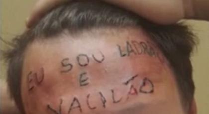 «Είμαι κλέφτης»: Έκαναν τατουάζ στο μέτωπο εφήβου για ένα ποδήλατο