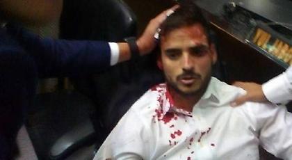 Βενεζουέλα: Οπαδοί του Μαδούρο εισέβαλαν στη Βουλή και τραυμάτισαν βουλευτές της αντιπολίτευσης