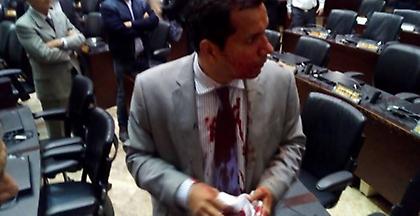 Βενεζουέλα: Αποχωρούν οι εγκλωβισμένοι βουλευτές από την Εθνοσυνέλευση