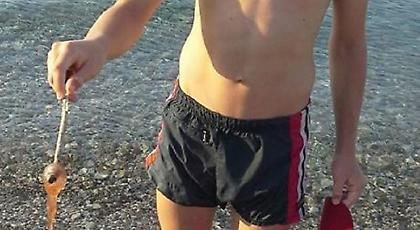 Τσούχτρες παντού στην Πάτρα: Για πρωτόγνωρο φαινόμενο μιλούν οι κάτοικοι (pics)