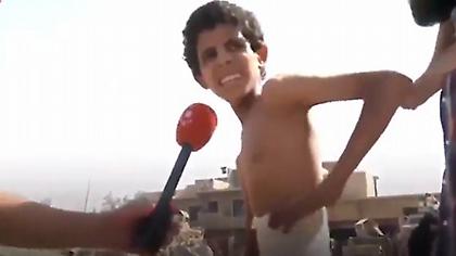 Συγκλονίζει το σκελετωμένο αγόρι της Μοσούλης που κρυβόταν σε υπόγειο