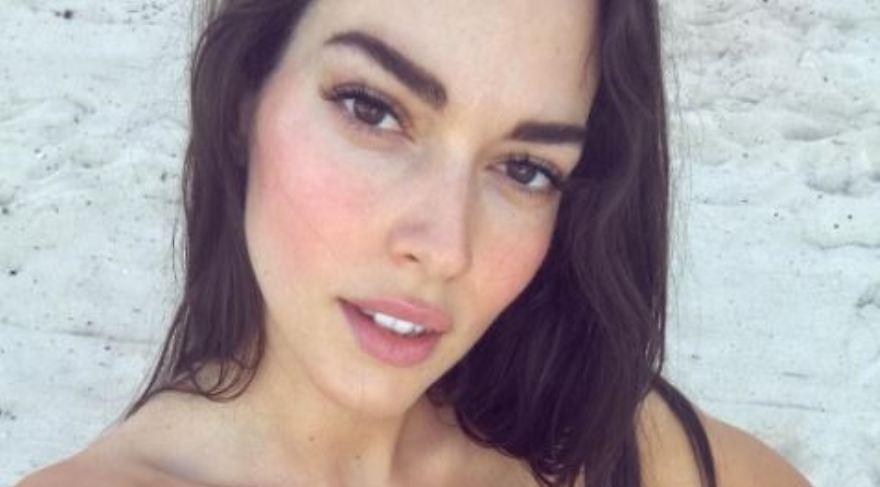 Συγκλονίζει η Ισμήνη Νταφοπούλου: Το ατύχημα σε φωτογράφηση που της σημάδεψε το πρόσωπο