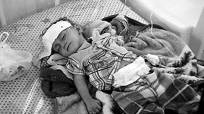 Υεμένη: Ο Ερυθρός Σταυρός αναμένει 600.000 κρούσματα χολέρας το 2017