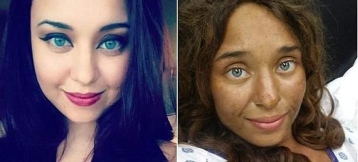 Εζησε την απόλυτη περιπέτεια επιβίωσης -Χάθηκε σε αχανές δάσος, έτρωγε μούρα και κατάφερε να ζήσει