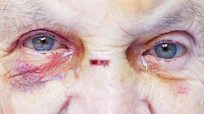 Κρήτη: Έβαλε κάμερες και είδε την κακοποίηση της 79χρονης μητέρας της