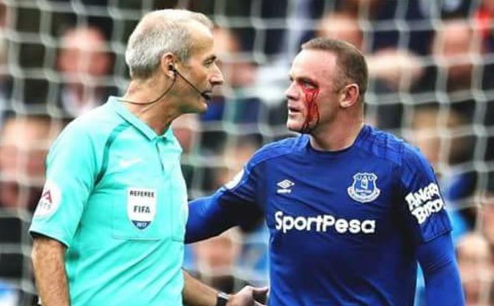 Σοκάρουν οι φωτογραφίες του Ρούνεϊ μετά από αγκωνιά που δέχτηκε (pics)