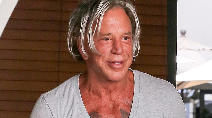 H selfie του Mickey Rourke με τον πλαστικό χειρουργό του, αμέσως μετά την πλαστική