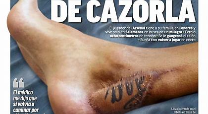 Το δράμα του Καθόρλα και η φωτογραφία-σοκ: «Παραλίγο να χάσω το πόδι μου»! (pic)