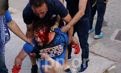 Άγριο ξύλο στο Αήττητος Σπάτων-Εθνικός (pics/video)