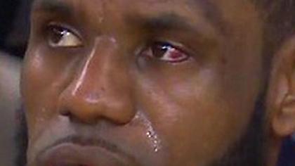 Η… δαχτυλιά του Γκριν προκάλεσε αιμάτωμα στο μάτι του Λεμπρόν (video)