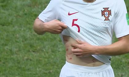 Τα… σημάδια που άφησε ο Άμραμπατ στο σώμα του Γκερέιρο (pics)