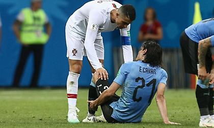 «Χλωμός» για τον προημιτελικό με Γαλλία ο Καβάνι